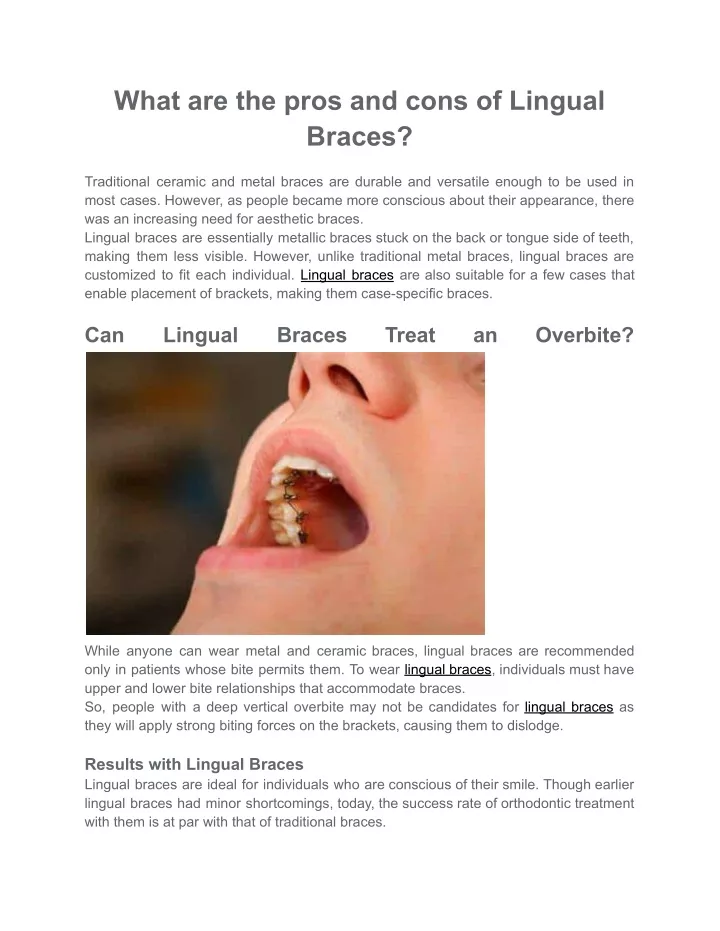 Ppt What Are The Pros And Cons Of Lingual Braces Dentist In Mumbai