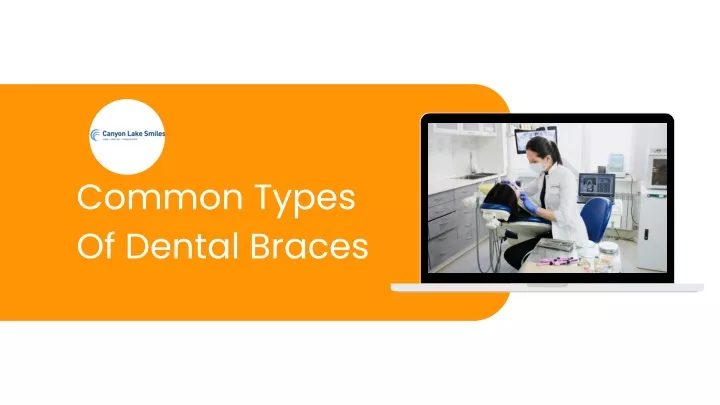 Ppt Common Types Of Dental Braces Powerpoint Presentation Free