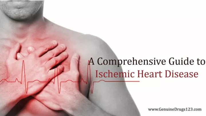 PPT A Comprehensive Guide To Ischemic Heart Disease PowerPoint