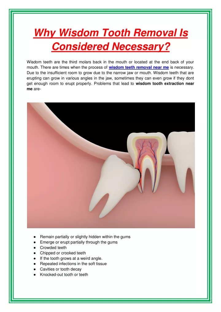 why wisdom tooth removal is considered necessary