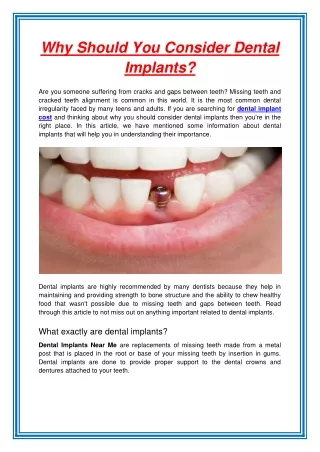 why should you consider dental implants