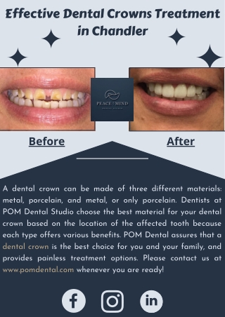 Effective Dental Crowns Treatment in Chandler