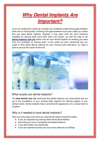 why dental implants are important