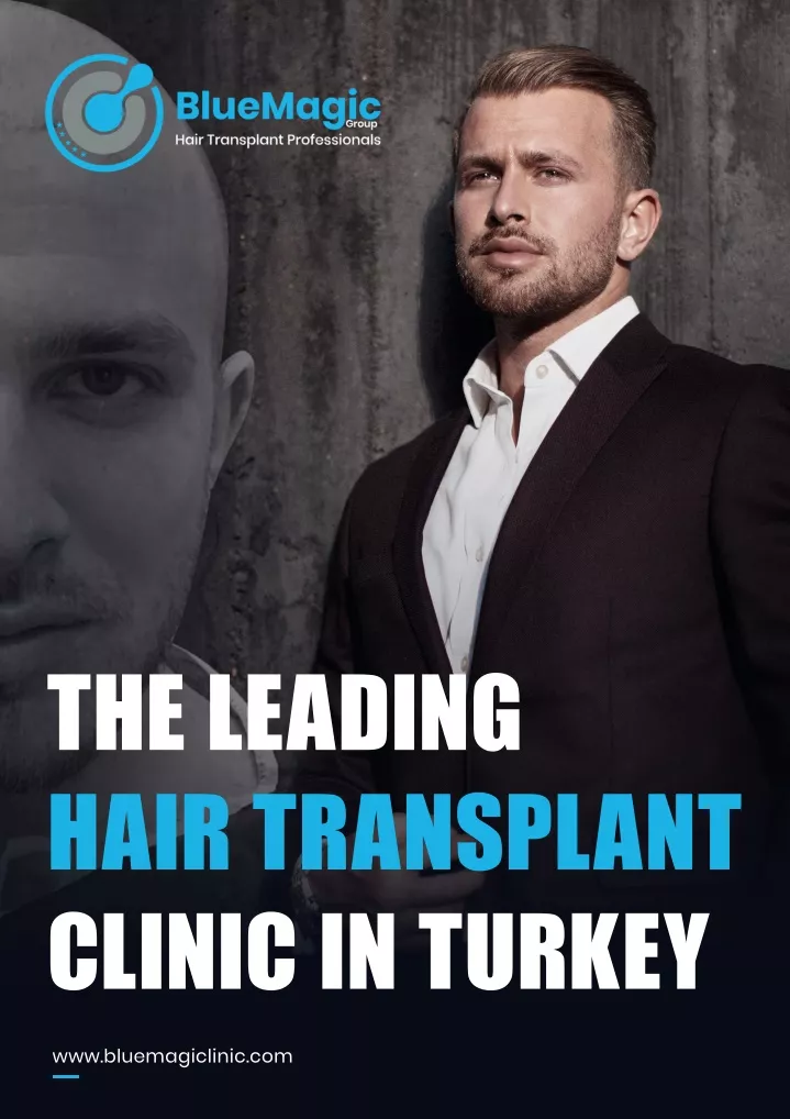 the leading hair transplant clinic in turkey