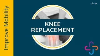 Improve Mobility After Knee Replacement Surgery