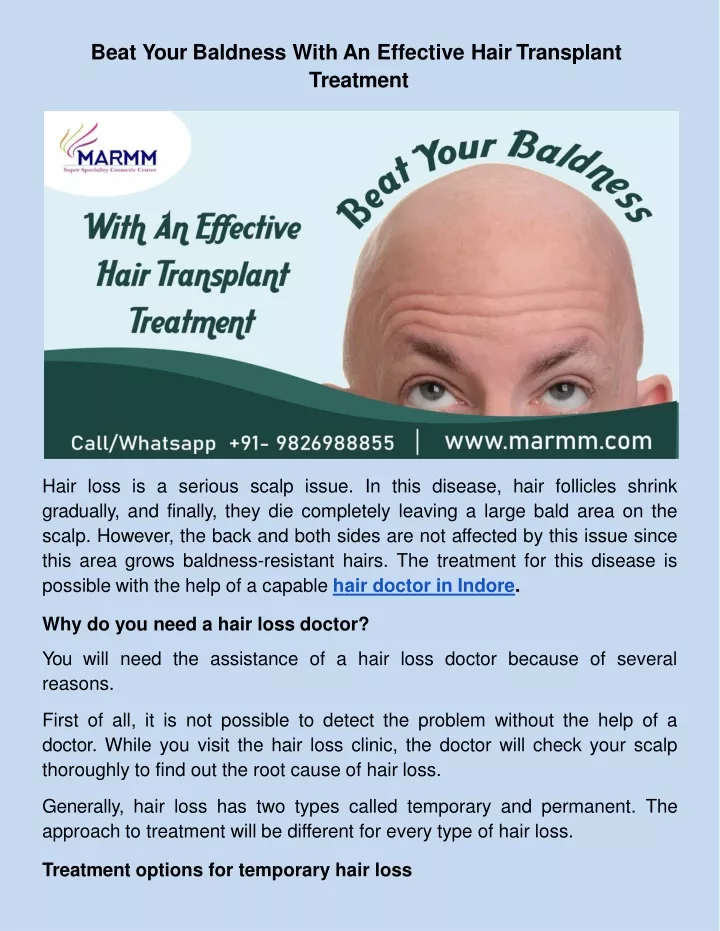 beat your baldness with an effective hair
