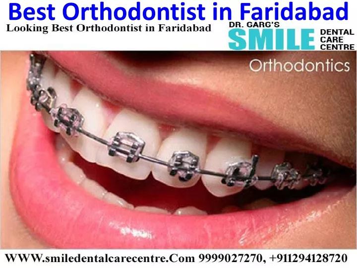 best orthodontist in faridabad