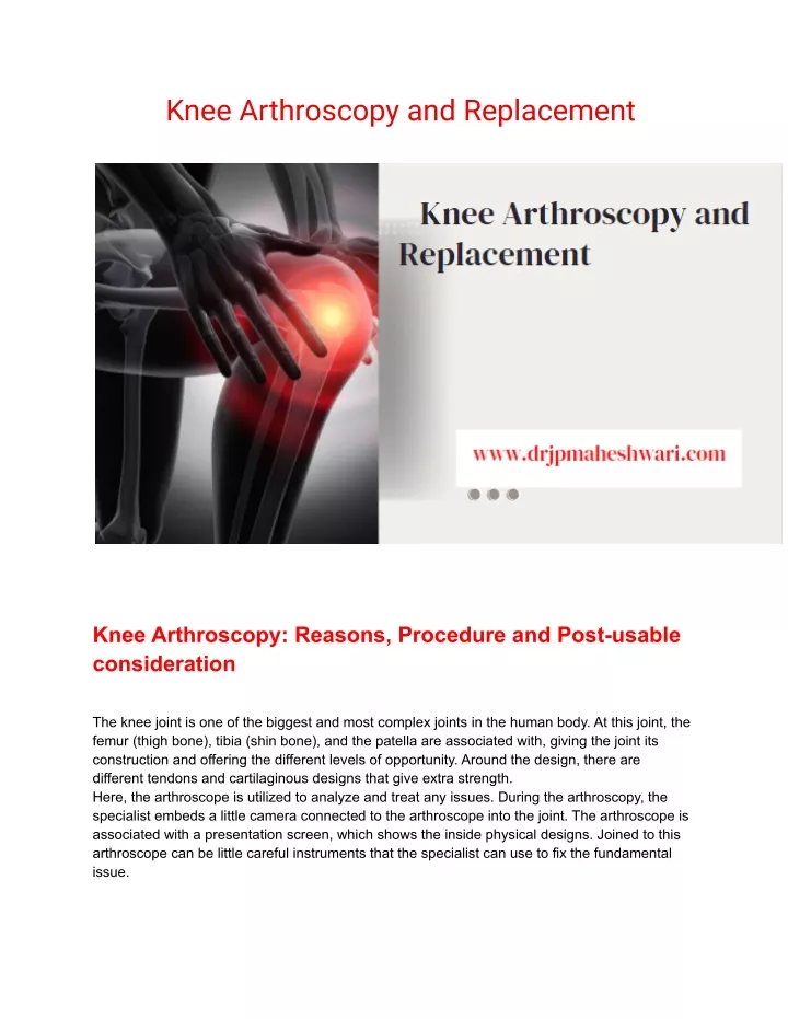 PPT - Knee Arthroscopy And Replacement PowerPoint Presentation, Free ...