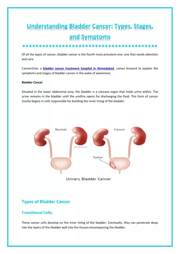 understanding bladder cancer types stages