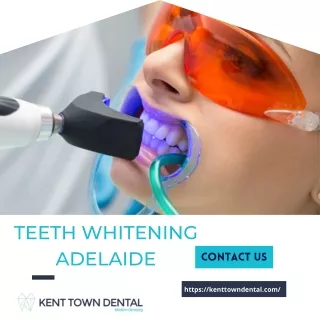 Teeth Whitening in Adelaide | Kent Town Dental