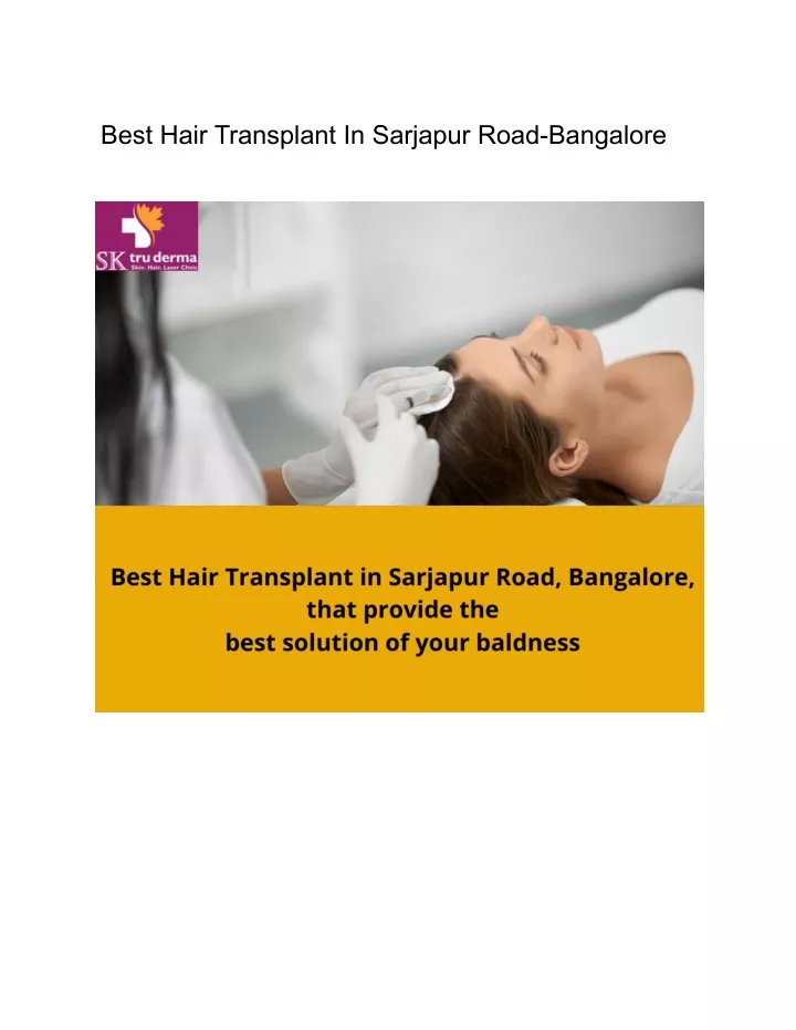 best hair transplant in sarjapur road bangalore