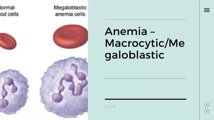 anemia macrocytic me galoblastic