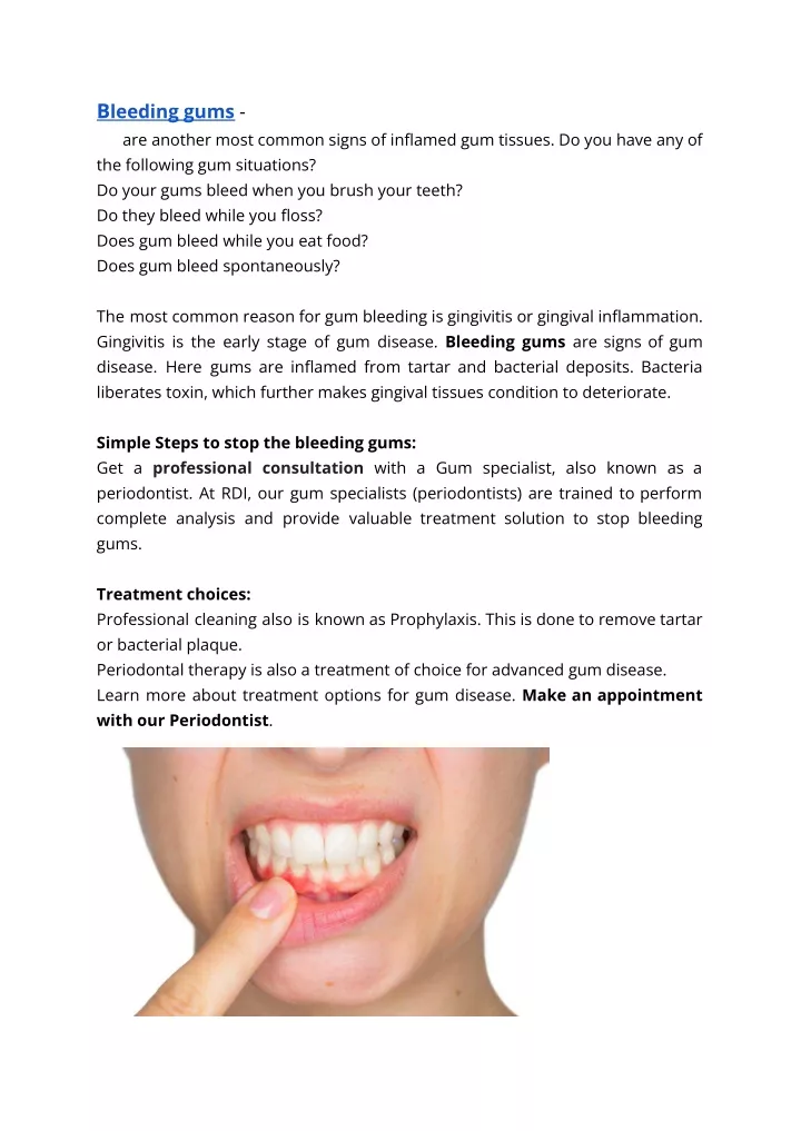 b leeding gums are another most common signs