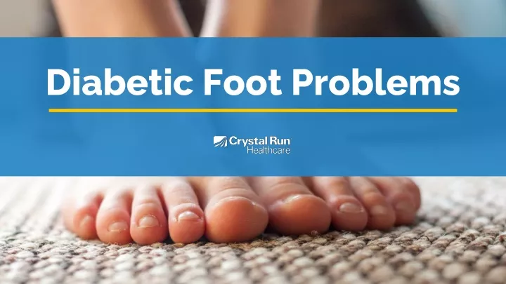 PPT - Diabetic Foot Problems PowerPoint Presentation, free download ...