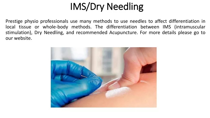 ims dry needling