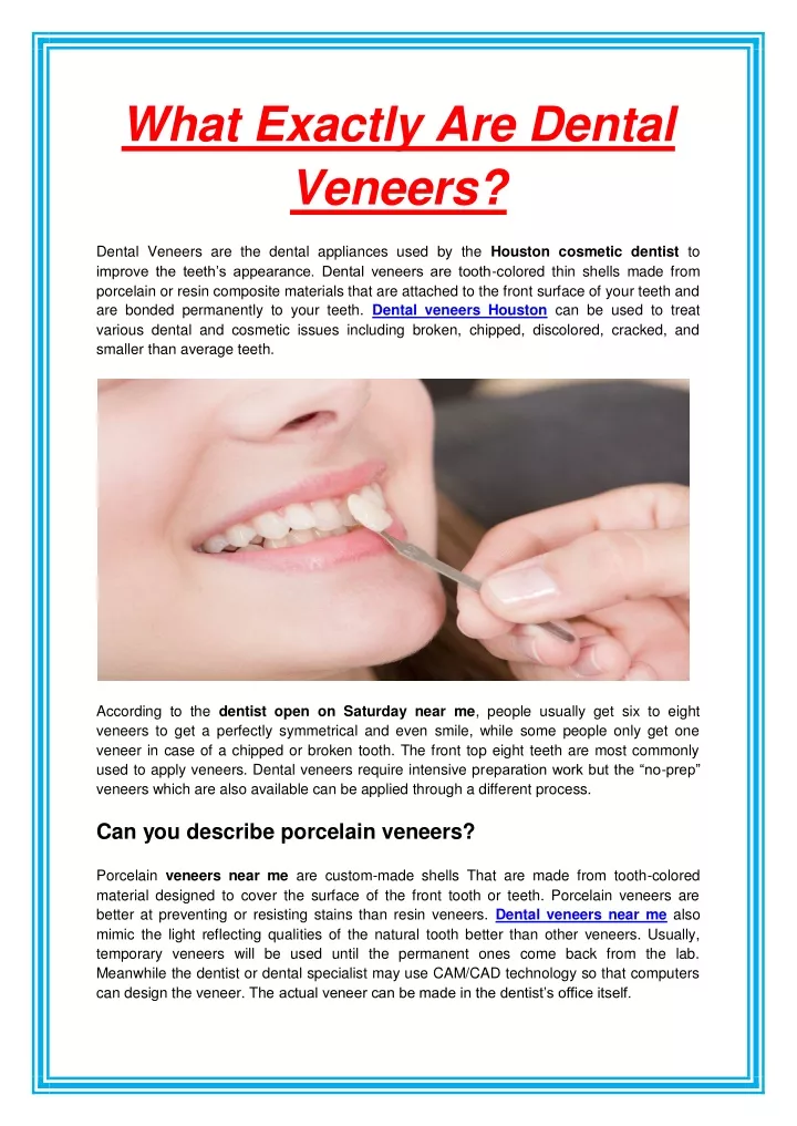 what exactly are dental veneers