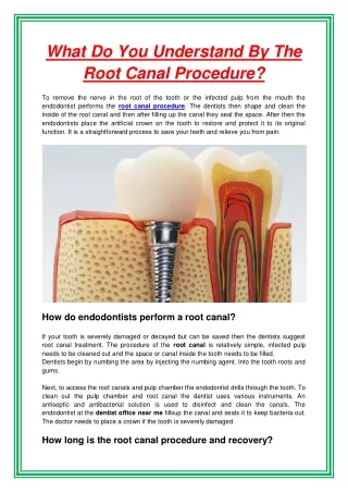 what do you understand by the root canal procedure