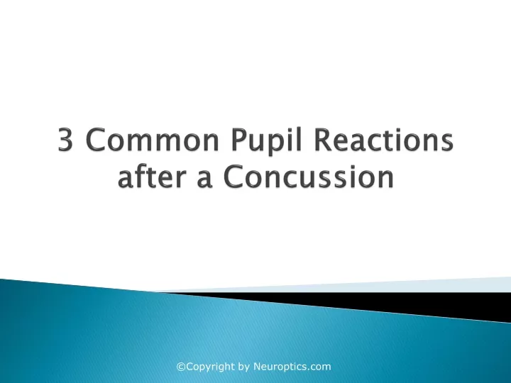 3 common pupil reactions after a concussion