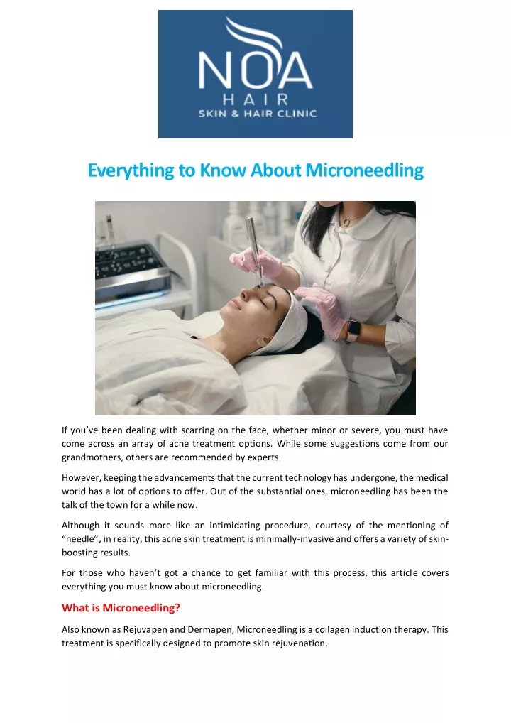 everything to know about microneedling