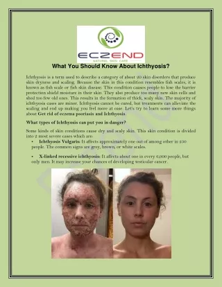 what you should know about ichthyosis