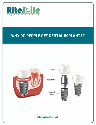 Why do people get dental implants?
