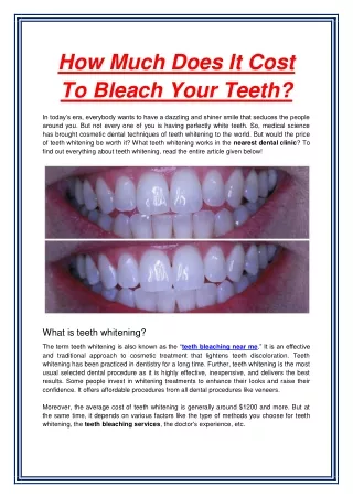 how much does it cost to bleach your teeth