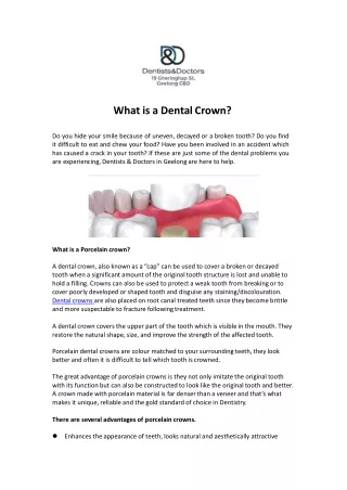Dentistsndoctors.com.au-What-Is-A-Dental-Crown-converted