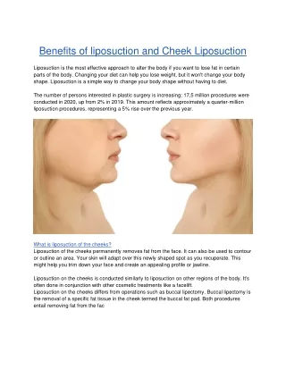 Benefits of liposuction and Cheek Liposuction-converted