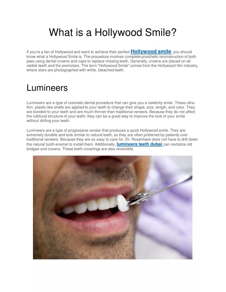 what is a hollywood smile
