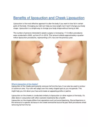 Benefits of liposuction and Cheek Liposuction