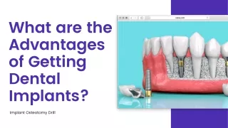 What are the Advantages of Getting Dental Implants
