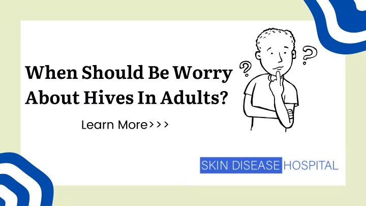 when should be worry about hives in adults learn