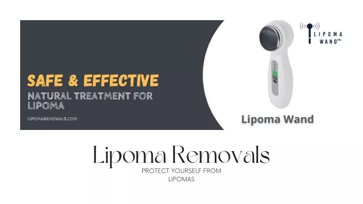 lipoma removals protect yourself from lipomas