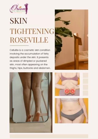 Result Oriented Skin Tightening Treatment Roseville | Orion Aesthetics