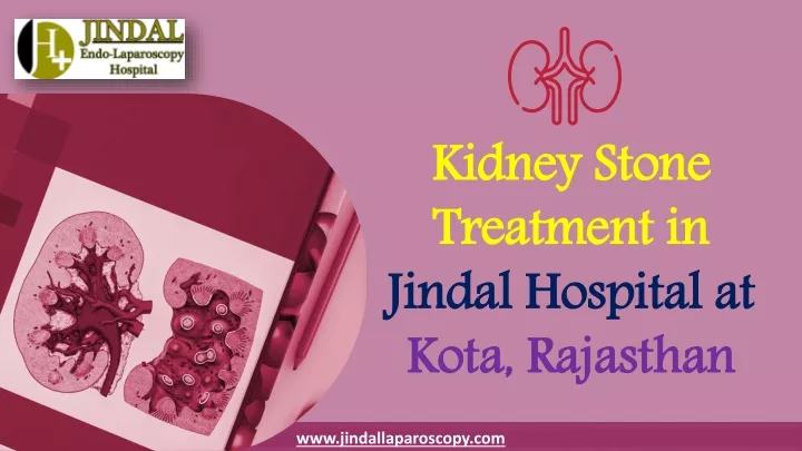 kidney stone treatment in jindal hospital at kota