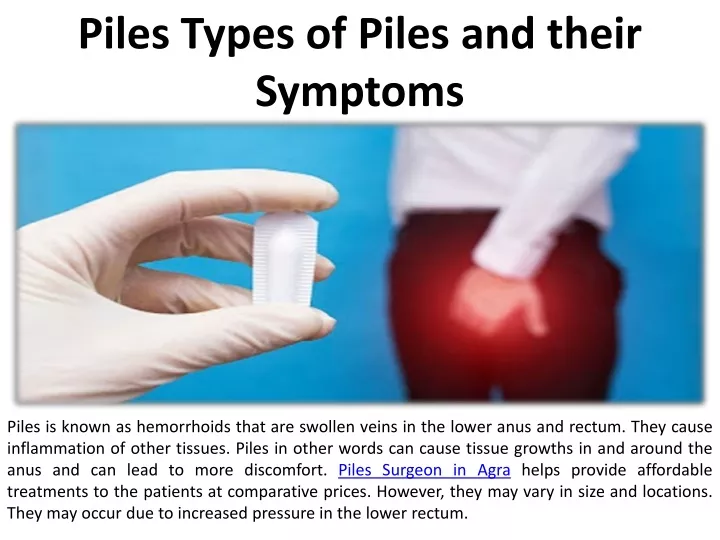 piles types of piles and their symptoms