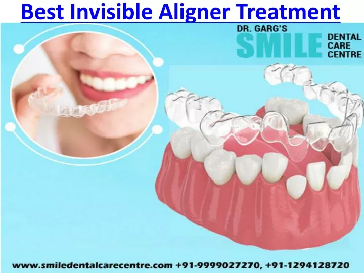 best invisible aligner treatment