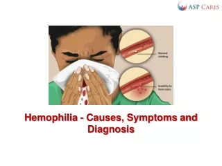 Hemophilia - Causes, Symptoms and Diagnosis
