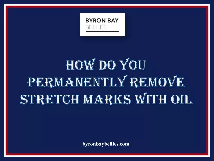 how do you permanently remove stretch marks with