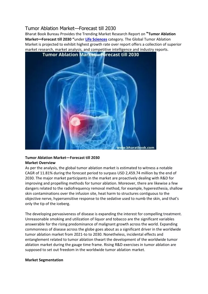 tumor ablation market forecast till 2030 bharat