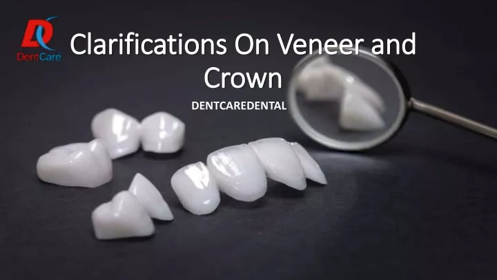 clarifications on veneer and crown