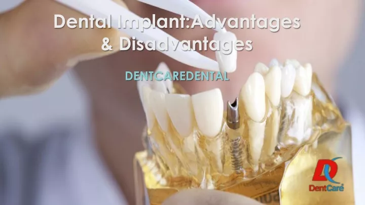 dental implant advantages disadvantages