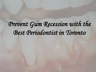 Prevent Gum Recession with the Best Periodontist in Toronto