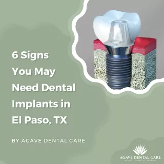 6 Signs You May Need Dental Implants | Implant Dentistry El Paso