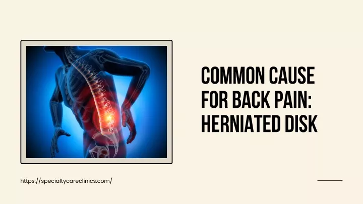 common cause for back pain herniated disk