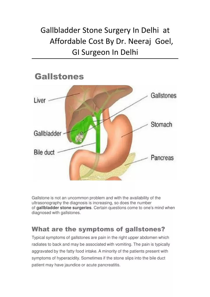gallbladder stone surgery in delhi at affordable cost by dr neeraj goel gi surgeon in delhi