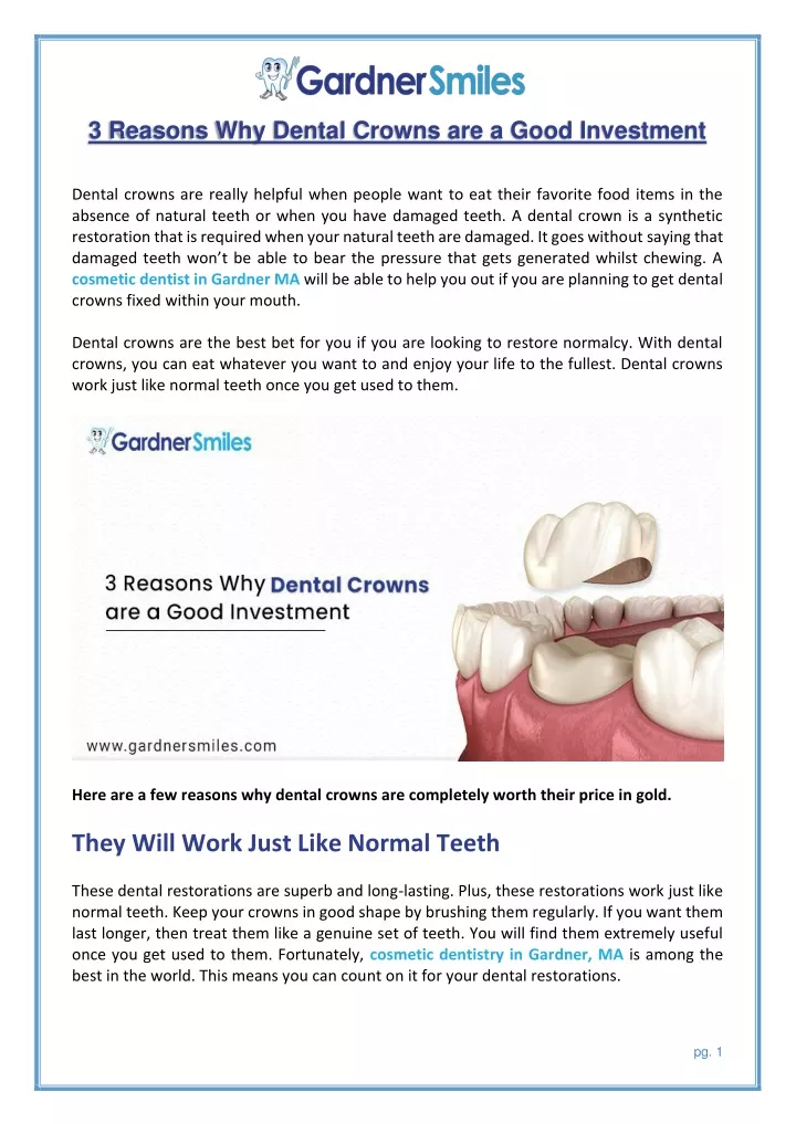 3 reasons why dental crowns are a good investment