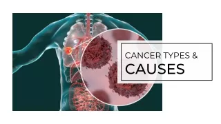 Cancer types and causes