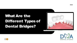 what are the different types of dental bridges