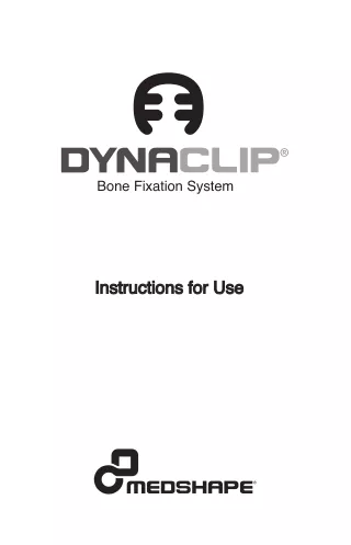 DynaClip Bone Fixation System | DJO Global